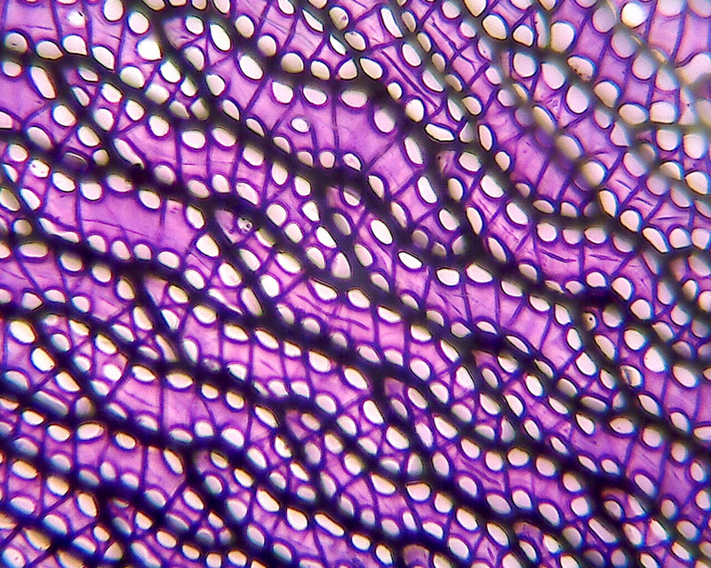 Sphagnum subsecundum